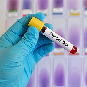 Thyroid Hormone Level Testing in Hudson, FL